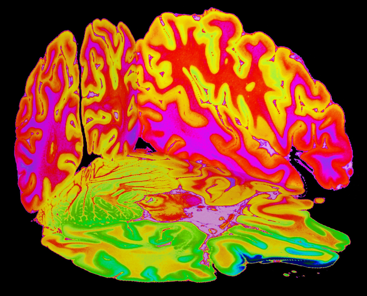Screenshot from DICOM 3D