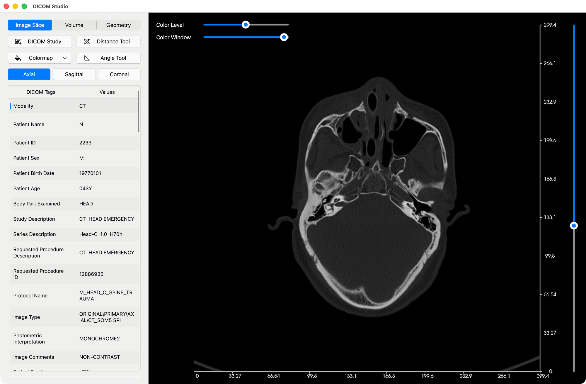 Import DICOM Study Result - DICOM Studio