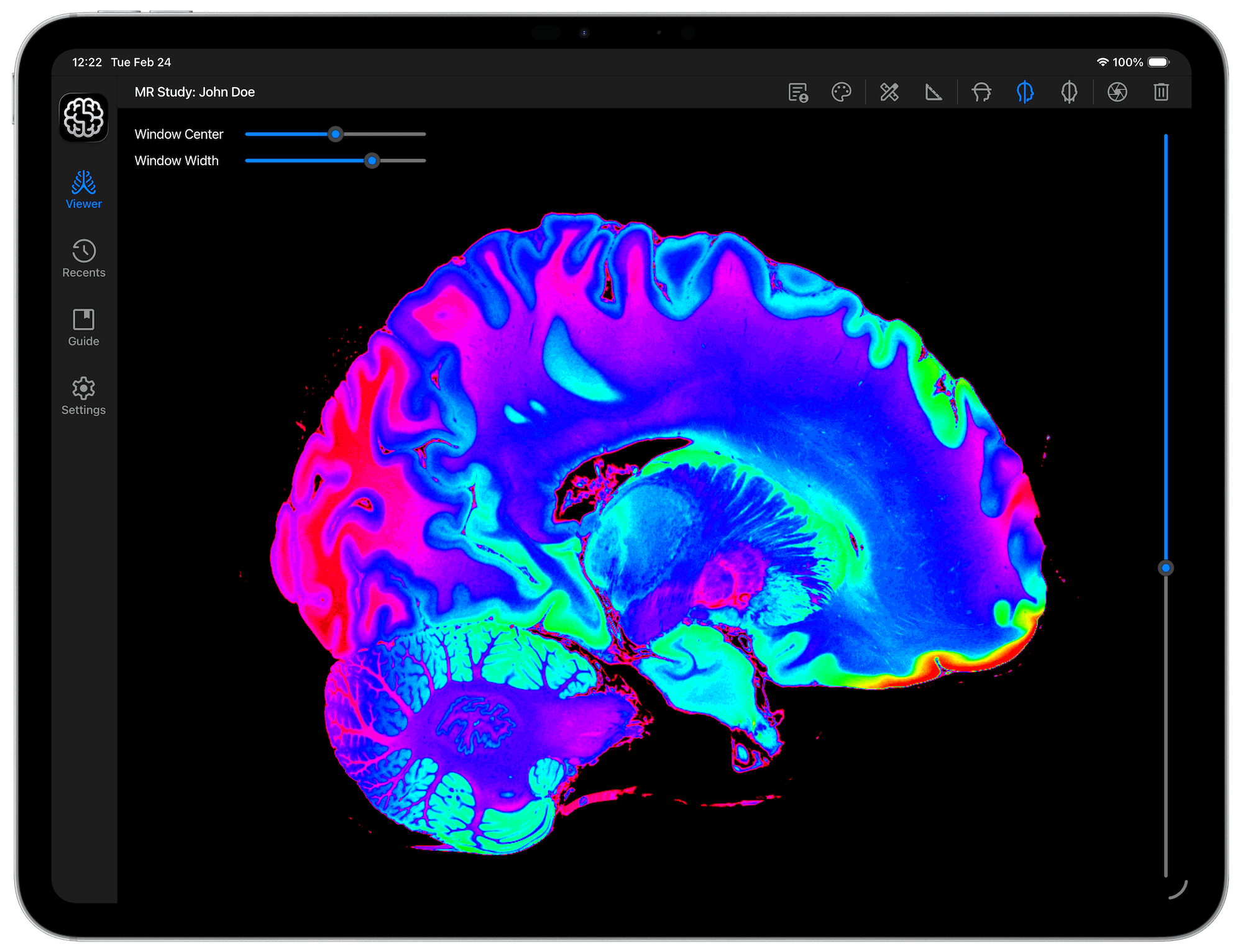 DICOM Studio Go on iPad