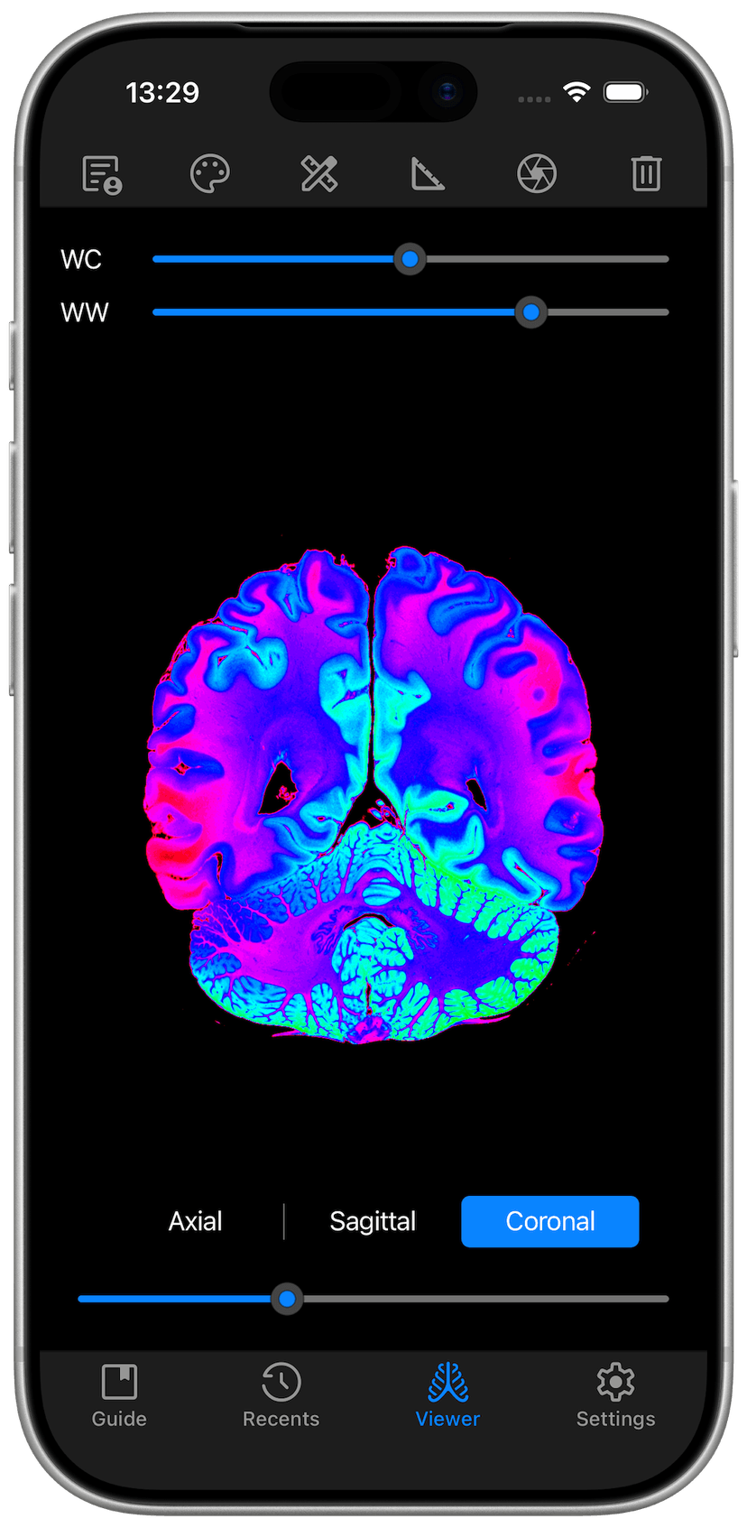 DICOM Studio Go on iPhone - Coronal View