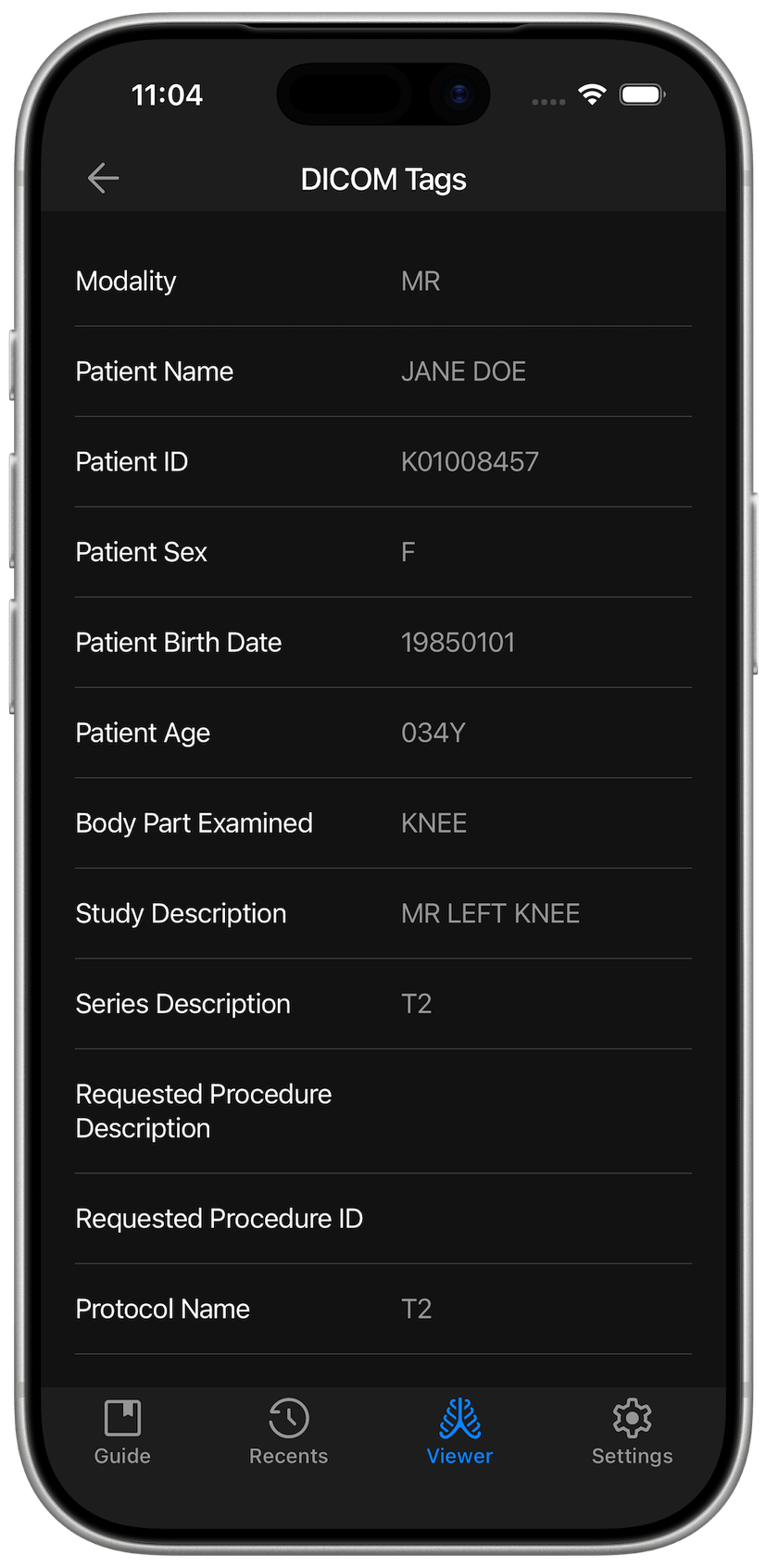 DICOM Studio Go on iPhone - DICOM Tags