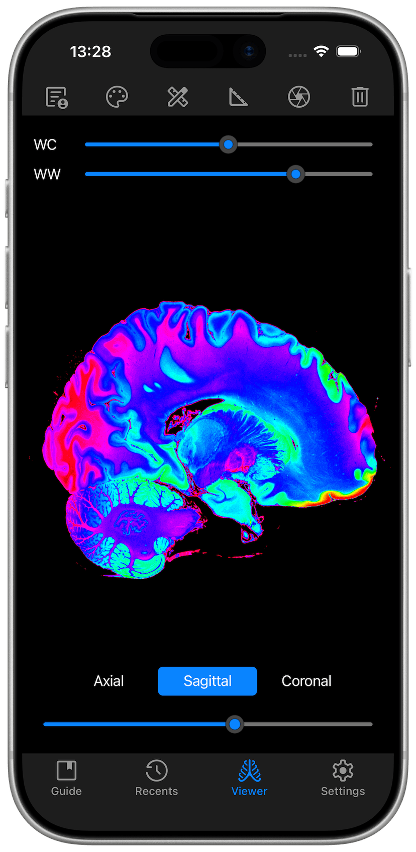 DICOM Studio Go on iPhone - Sagittal View