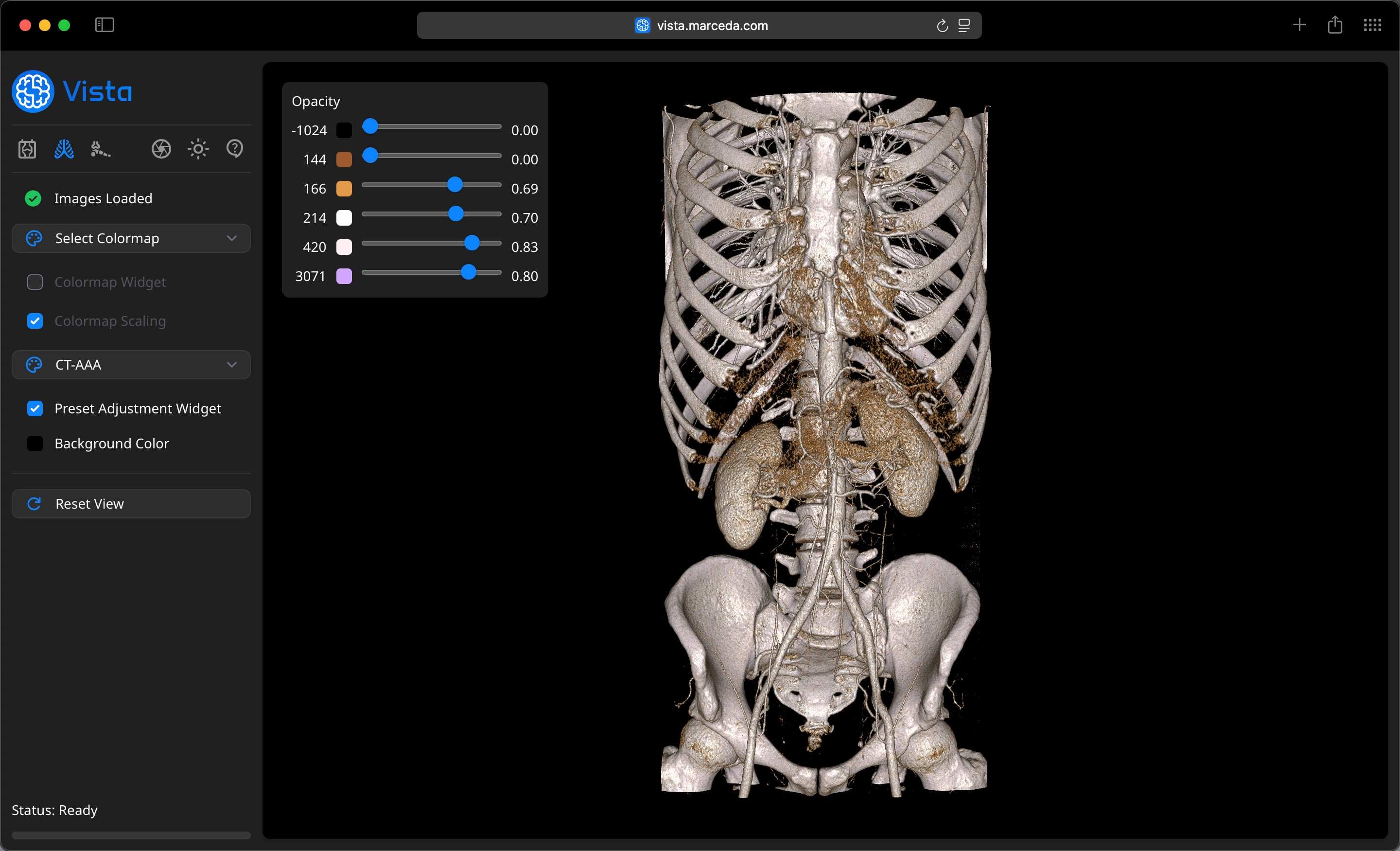 Medical Color Preset applied to CT Image Data on Vista
