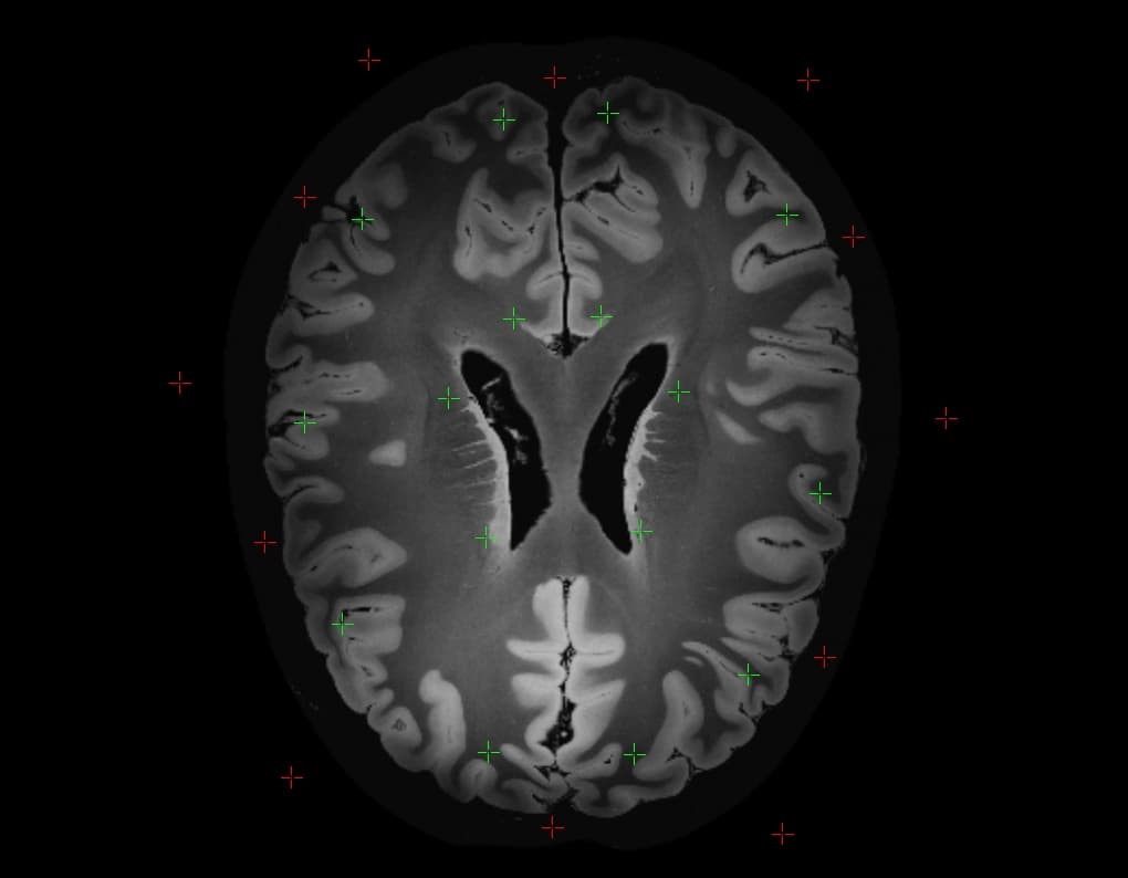 DICOM 3D Screenshot