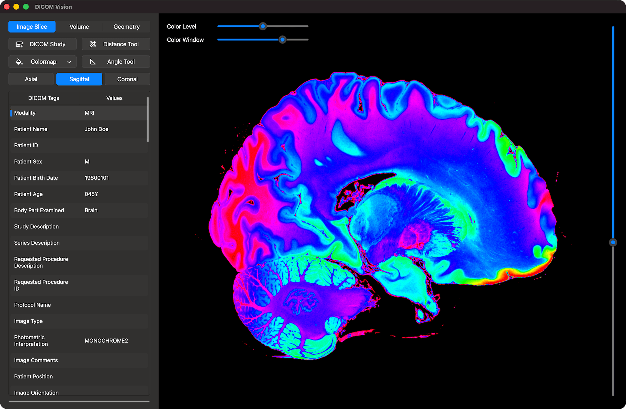 DICOM Vision 2 on Mac