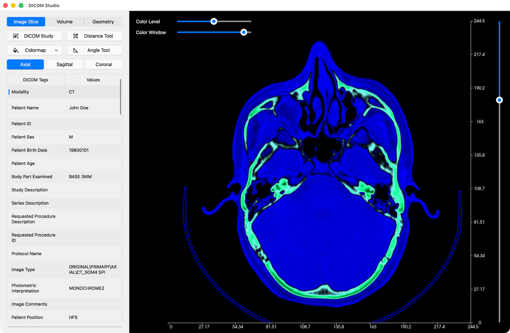 Colormap Applied to DICOM Slice - DICOM Studio