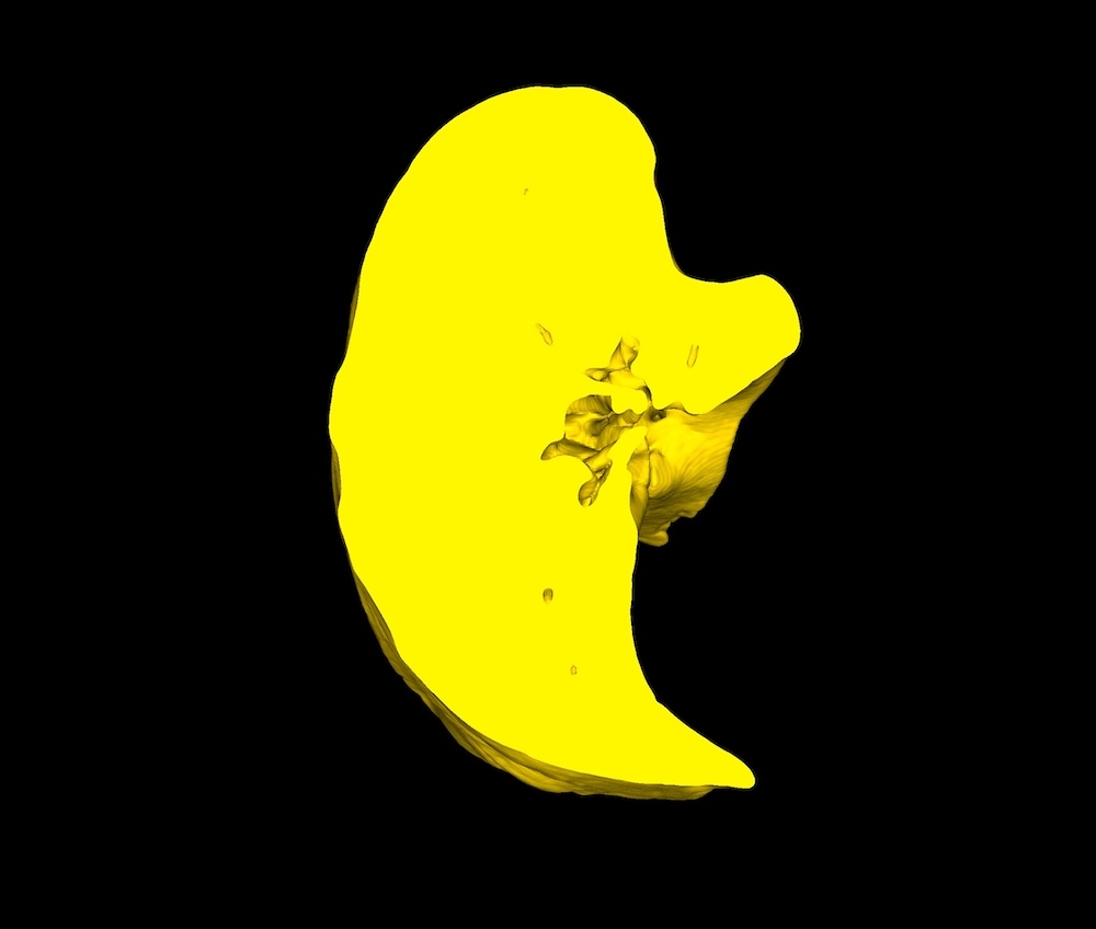 Crop with Closed Edges - DICOM Studio