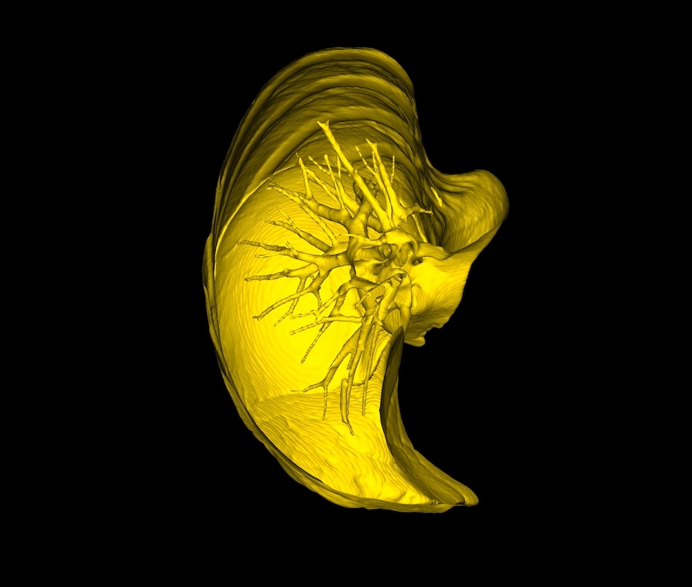 Crop with Open Edges - DICOM Studio