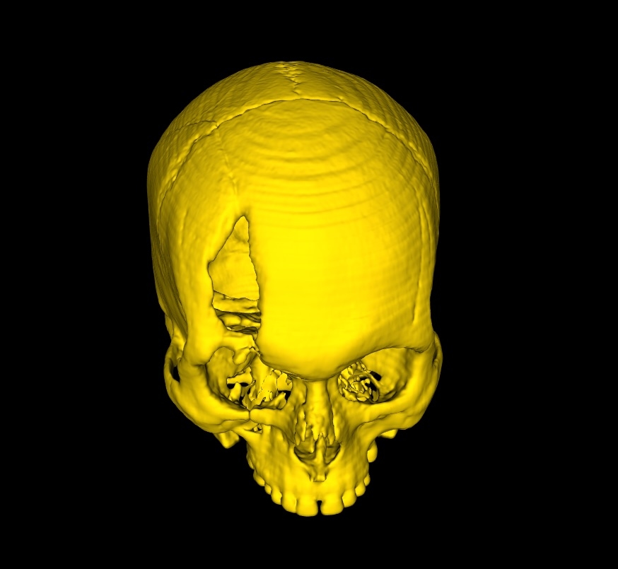 Crop with Open Edges - DICOM Studio