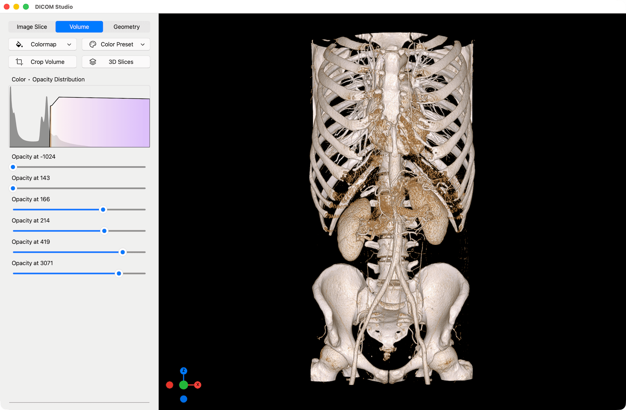 Volume Color Preset - DICOM Studio