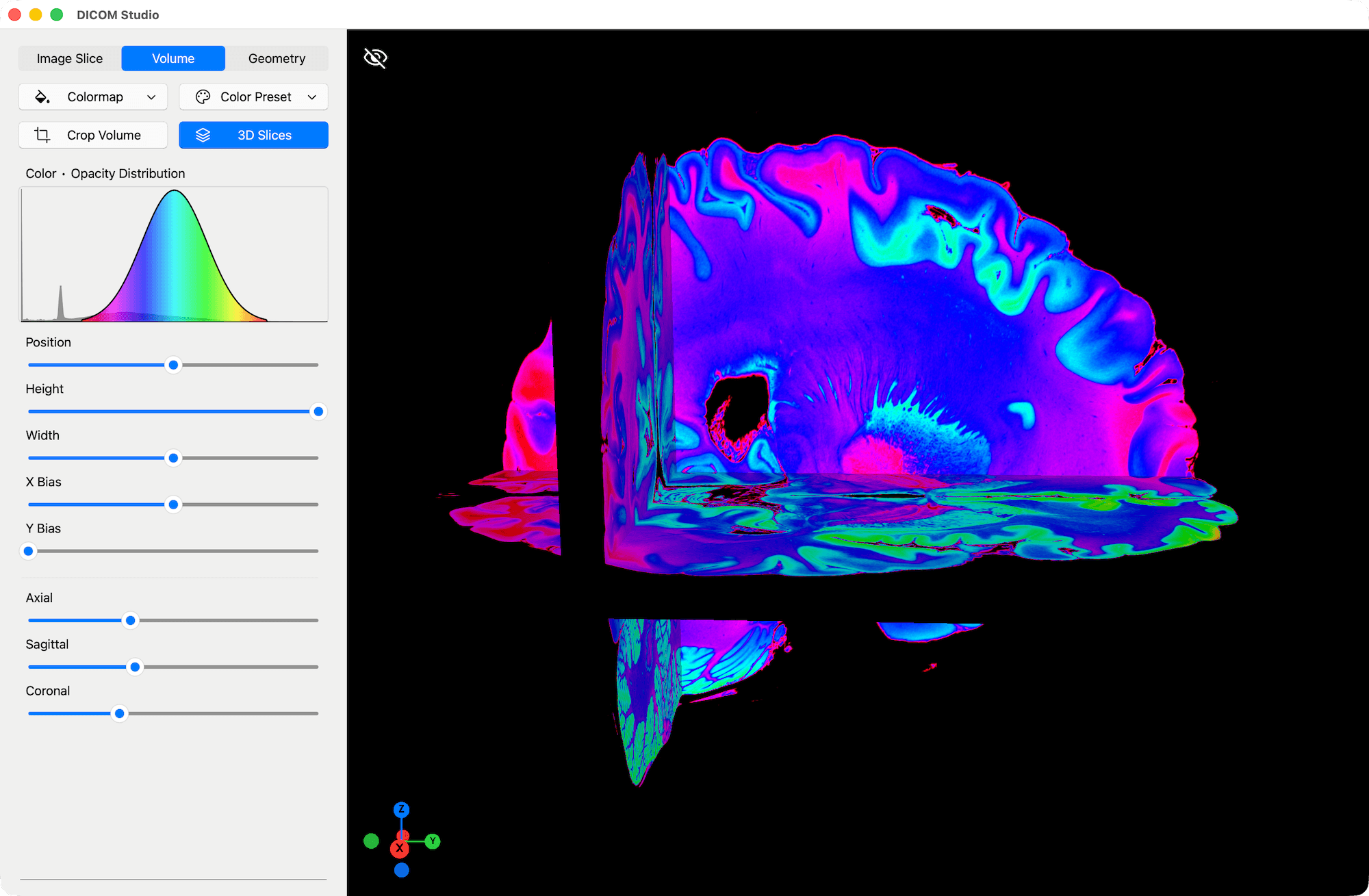 3D Slices - DICOM Studio