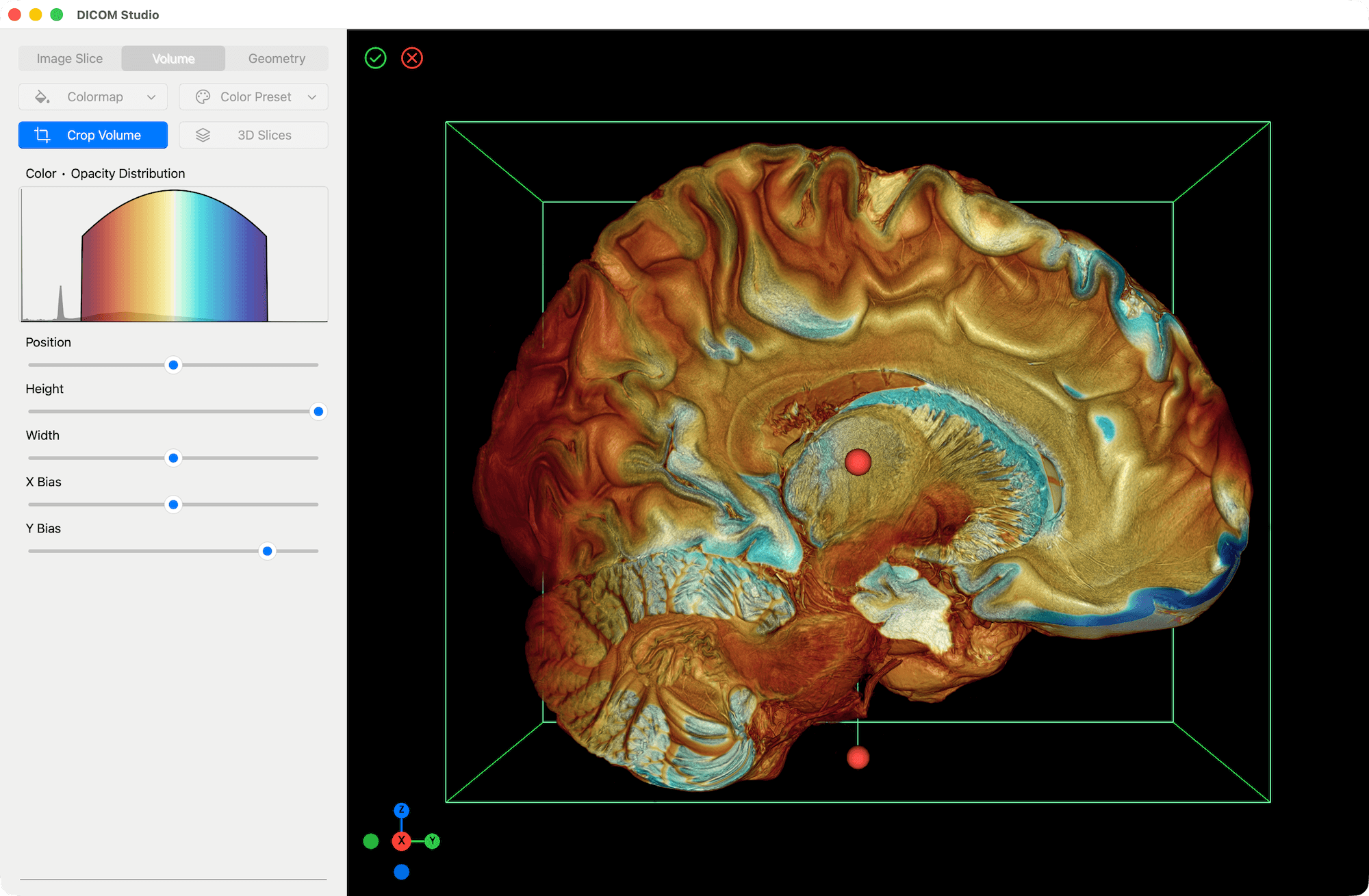 Volume Crop After - DICOM Studio