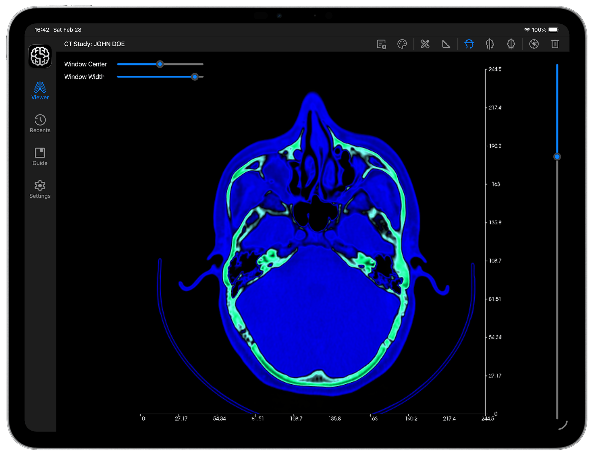 DICOM Studio Go on iPad - Before Colormap is Applied