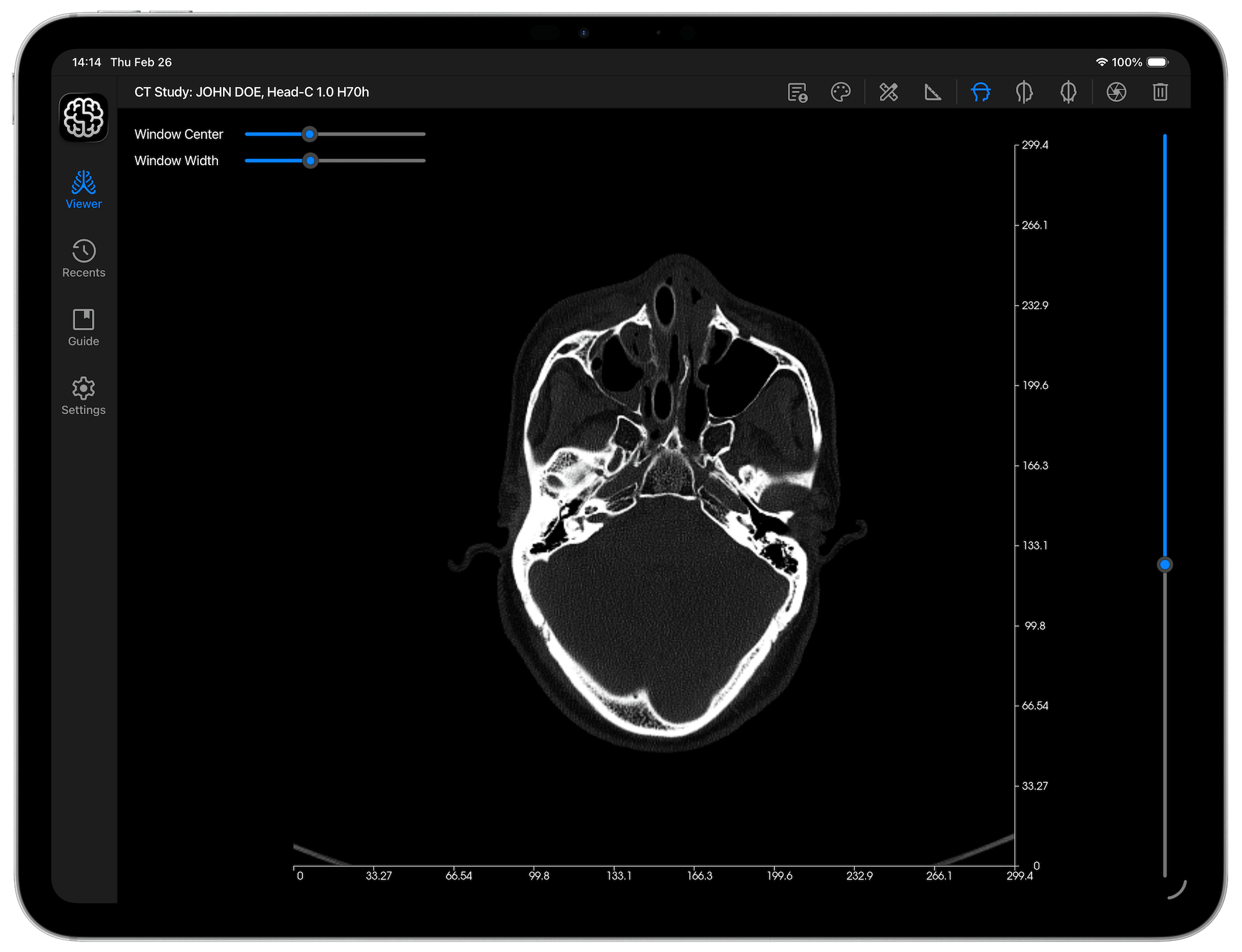 DICOM Studio Go on iPad - Select DICOM Folder (Landscape View)
